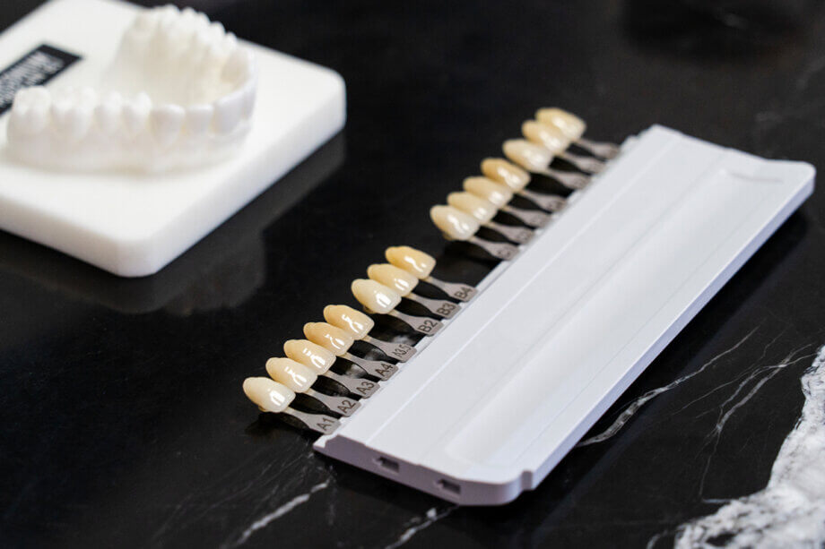 How Porcelain Veneers Can Improve Your Smile