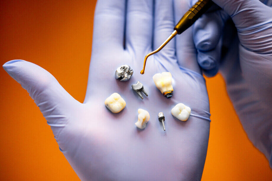The Pros and Cons of Dental Crowns